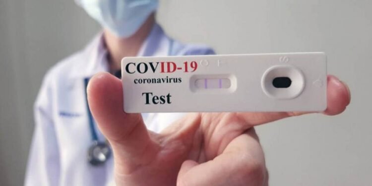 Llegan los autotest de coronavirus a las farmacias para su venta al público