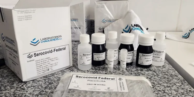 Científicas argentinas desarrollaron un test para COVID-19 que podrá usarse en humanos y animales
