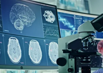 Después del COVID grave, el cerebro puede sufrir cambios similares a la enfermedad de Alzheimer