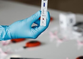 Coronavirus en Argentina: confirmaron 54 muertes y 6.137 contagios en las últimas 24 horas