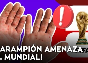 Consejos esenciales para hinchas que asistirán al Mundial frente al brote de sarampión en EE.UU., México y Canadá