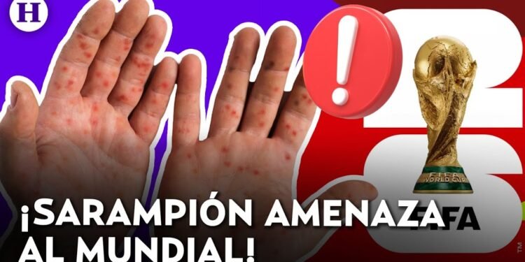 Consejos esenciales para hinchas que asistirán al Mundial frente al brote de sarampión en EE.UU., México y Canadá