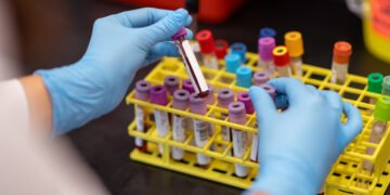 Cerca de 13 mil nuevos casos de enfermedades oncohematológicas son registrados anualmente en Argentina